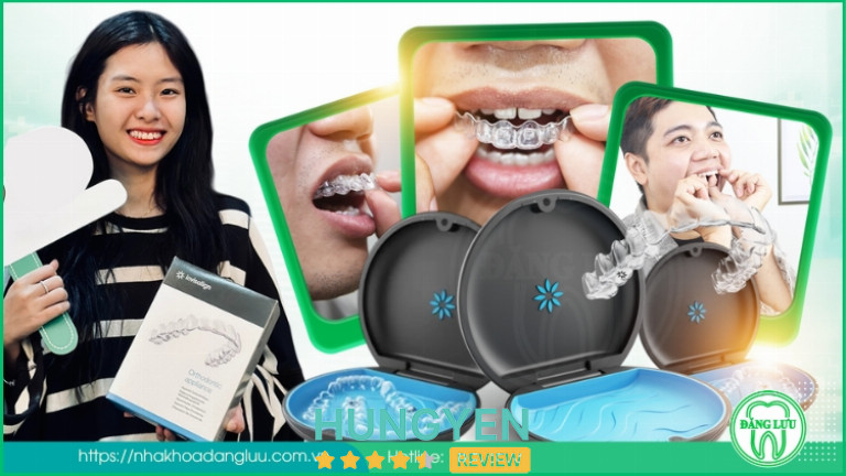 Niêng răng Invisalign là phương pháp chỉnh nha nổi bật tại Nha Khoa Đăng Lưu